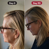 Side view of a woman with blonde hair and glasses, photos labeled Day 0 and Day 90